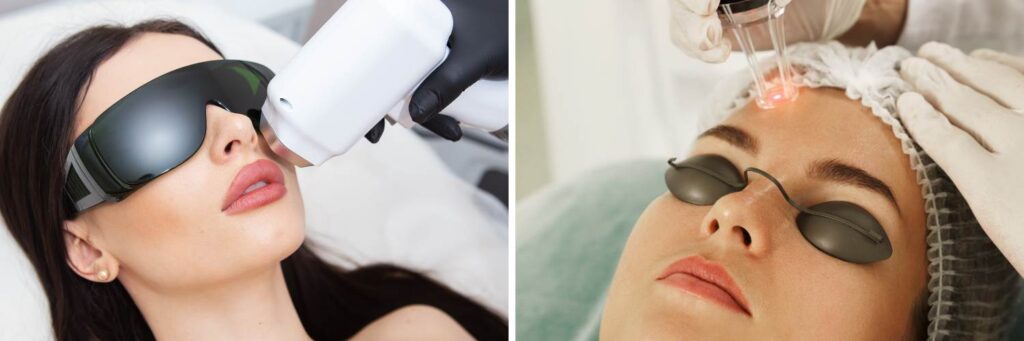 IPL vs. Laser Resurfacing: Which Treatment Truly Revives Your Skin?