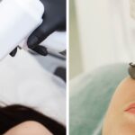 IPL vs. Laser Resurfacing: Which Treatment Truly Revives Your Skin?