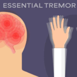 Stress, Anxiety, and Tremors: How Mental Health Affects the Nervous System
