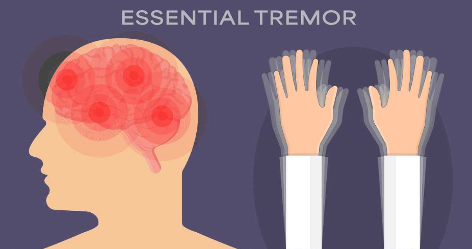 Stress, Anxiety, and Tremors: How Mental Health Affects the Nervous System